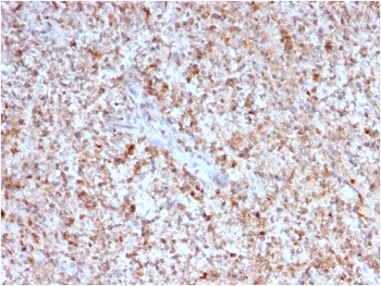 IHC testing of FFPE human spleen with CD40L antibody. HIER: boil tissue sections in pH6, 10mM citrate buffer, for 10-20 min followed by cooling at RT for 20 min.