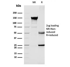 SDS-PAGE analysis of purified, BSA-free CD40L antibody (clone CD40LG/2763) as confirmation of integrity and purity.