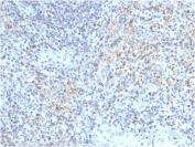 IHC testing of FFPE human spleen with CD40L antibody (clone CD40LG/2763). HIER: boil tissue sections in pH6, 10mM citrate buffer, for 10-20 min followed by cooling at RT for 20 min.