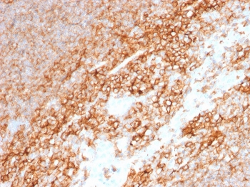 IHC staining of FFPE human tonsil with CD44 antibody (clone BU75). HIER: boil tissue sections in pH 9 10mM Tris with 1mM EDTA for 20 min and allow to cool before testing.~