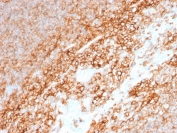 IHC staining of FFPE human tonsil with CD44 antibody (clone BU75). HIER: boil tissue sections in pH 9 10mM Tris with 1mM EDTA for 20 min and allow to cool before testing.