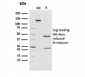 SDS-PAGE analysis of purified, BSA-free CD44v4/5 antibody (clone 3D2) as confirmation of integrity and purity.