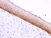 IHC staining of FFPE human cervix with CD44v4/5 antibody (clone 3D2). HIER: boil tissue sections in pH 9 10mM Tris with 1mM EDTA for 20 min and allow to cool before testing.