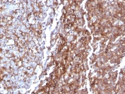 IHC staining of FFPE human tonsil tissue with recombinant CD44 antibody (clone rHCAM/918). HIER: boil tissue sections in pH 9 10mM Tris with 1mM EDTA for 20 min and allow to cool before testing.