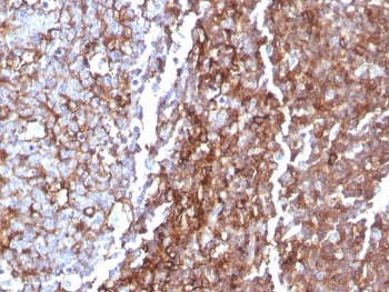 IHC staining of FFPE human tonsil tissue with recombinant CD44 antibody (clone rHCAM/918). HIER: boil tissue sections in pH 9 10mM Tris with 1mM EDTA for 20 min and allow to cool before testing.