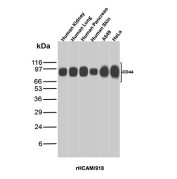 CD44 Antibody Human Tissue WB. Western blot analysis of CD44 / CD44 antigen expression in human tissue lysates using recombinant mouse monoclonal antibody clone rHCAM/918. Lanes include human kidney, lung, pancreas, skin, and cultured cell lines. Bands are detected at approximately 80-95 kDa, consistent with the predicted molecular weight of CD44, with variation in intensity reflecting tissue-dependent expression levels and glycosylation status.