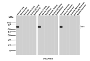 CD44 Antibody Human Multi-Tissue WB. Western blot analysis of CD44 / CD44 antigen expression across multiple human tissue lysates using recombinant mouse monoclonal antibody clone rHCAM/918. Bands are detected within the 75-100 kDa range, consistent with CD44 molecular weight and glycosylation-dependent migration. The pattern demonstrates variable expression across tissues, supporting its use for comparative human protein analysis.