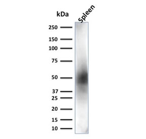Western blot testing of human spleen lysate with CD63 antibody (clone LAMP3/2881). Predicted molecular weight: 25-60 kDa depending on glycosylation level.