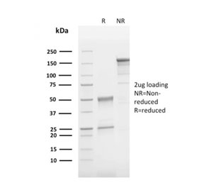 SDS-PAGE analysis of purified, BSA-free CD63 antibody (clone LAMP3/2790) as confirmation of integrity and purity.