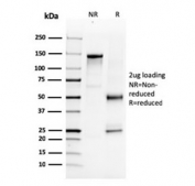 SDS-PAGE analysis of purified, BSA-free NKX3.1 antibody (clone NKX3.1/3347) as confirmation of integrity and purity.