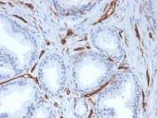 IHC staining of FFPE human prostate with CD31 antibody (clone PECAM1/3527). HIER: boil tissue sections in pH 9 10mM Tris with 1mM EDTA for 10-20 min and allow to cool before testing.