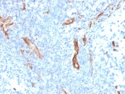 IHC staining of FFPE human prostate with CD31 antibody (clone PECAM1/3527). HIER: boil tissue sections in pH 9 10mM Tris with 1mM EDTA for 10-20 min and allow to cool before testing.