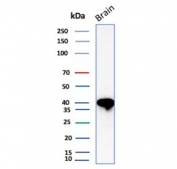 Western blot testing of human brain lysate with CD63 antibody (clone LAMP3/2789). Predicted molecular weight: 25-60 kDa depending on glycosylation level.