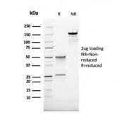 SDS-PAGE analysis of purified, BSA-free recombinant CD68 antibody (clone rLAMP4/824) as confirmation of integrity and purity.