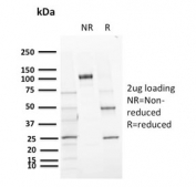 SDS-PAGE analysis of purified, BSA-free CD72 antibody (clone BU40) as confirmation of integrity and purity.