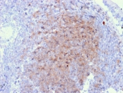 IHC staining of FFPE human lymph node with CD72 antibody (clone BU40). HIER: boil tissue sections in pH 9 10mM Tris with 1mM EDTA for 20 min and allow to cool before testing.