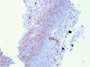 IHC staining of FFPE human lymph node with CD72 antibody (clone BU40). HIER: boil tissue sections in pH 9 10mM Tris with 1mM EDTA for 20 min and allow to cool before testing.