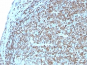 IHC staining of FFPE human tonsil with recombinant CD74 antibody (clone CLIP/3127R). HIER: boil tissue sections in pH 9 10mM Tris with 1mM EDTA for 20 min and allow to cool before testing.