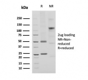 SDS-PAGE analysis of purified, BSA-free recombinant CD74 antibody (clone CLIP/3127R) as confirmation of integrity and purity.