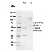 SDS-PAGE analysis of purified, BSA-free CD79b antibody (clone B29/123) as confirmation of integrity and purity.