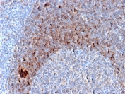 IHC staining of FFPE human tonsil tissue with CD79b antibody (clone B29/123). HIER: boil tissue sections in pH 9 10mM Tris with 1mM EDTA for 10-20 min followed by cooling at RT for 20 min.