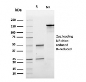 SDS-PAGE analysis of purified, BSA-free E-Cadherin antibody (clone CDH1/3256) as confirmation of integrity and purity.