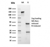 SDS-PAGE analysis of purified, BSA-free Cytokeratin 20 antibody (clone KRT20/3145) as confirmation of integrity and purity.
