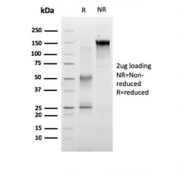 SDS-PAGE analysis of purified, BSA-free RET antibody (clone RET/2663) as confirmation of integrity and purity.