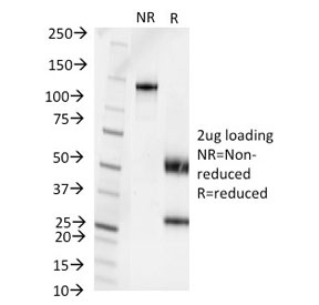 SDS-PAGE analysis of purified, BSA-free Pseudomonas aeruginosa serotype 6C antibody (clone 1200/472) as confirmation of integrity and purity.