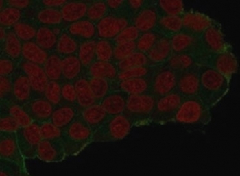 Immunofluorescent staining of PFA-fixed human MCF7 cells that have been transfected with an HA-tagged protein, with HA Tag antibody (clone 16.43, green) and Reddot nuclear stain (red).~