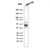 Western blot testing of MBP-tagged recombinant protein with MBP tag antibody. 