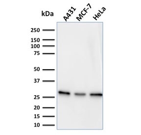 Western blot testing of human samples with Myofibroblast antibody (clone PR 2D3). ~