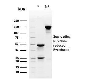 SDS-PAGE analysis of purified, BSA-free Myofibroblast antibody (clone PR 2D3) as confirmation of integrity and purity.