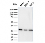 Western blot testing of human samples with Myofibroblast antibody (clone PR 2D3). 