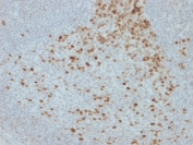IHC staining of FFPE human lymph node with Proliferation Marker antibody (clone JC1). HIER: boil tissue sections in pH 9 10mM Tris with 1mM EDTA for 20 min and allow to cool before testing.