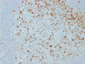 IHC staining of FFPE human lymph node with Proliferation Marker antibody (clone JC1). HIER: boil tissue sections in pH 9 10mM Tris with 1mM EDTA for 20 min and allow to cool before testing.~