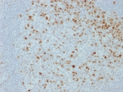 IHC staining of FFPE human lymph node with Proliferation Marker antibody (clone JC1). HIER: boil tissue sections in pH 9 10mM Tris with 1mM EDTA for 20 min and allow to cool before testing.