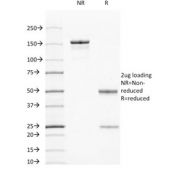 SDS-PAGE analysis of purified, BSA-free Cytokeratin 7/17 antibody (clone C-46) as confirmation of integrity and purity.