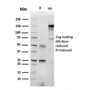 SDS-PAGE analysis of purified, BSA-free c-RET antibody (clone RET/2976) as confirmation of integrity and purity.