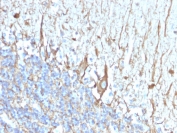 IHC staining of FFPE human cerebellum with Neurofilament antibody (clone 2F11). HIER: boil tissue sections in pH 9 10mM Tris with 1mM EDTA for 20 min and allow to cool before testing.