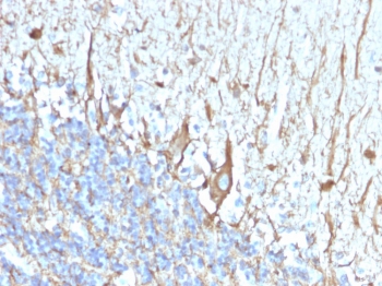IHC staining of FFPE human cerebellum with Neurofilament antibody (clone 2F11). HIER: boil tissue sections in pH 9 10mM Tris with 1mM EDTA for 20 min and allo