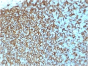 IHC testing of FFPE human tonsil tissue with recombinant Pan-HLA antibody (clone rHLA-Pan/3475). Required HIER: boil tissue sections in pH 9 10mM Tris with 1mM EDTA for 10-20 min and allow to cool prior to testing.
