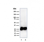 Western blot testing of human 1) Ramos and 2) spleen tissue lysate with recombinant Pan-HLA antibody (clone rHLA-Pan/3475).