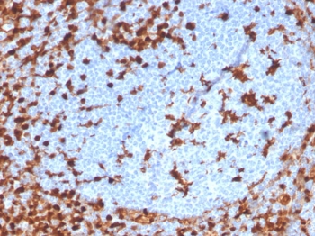 IHC staining of FFPE human tonsil wit