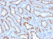 IHC staining of FFPE human kidney with recombinant Interferon gamma antibody (clone IFNG/3996R). HIER: boil tissue sections in pH 9 10mM Tris with 1mM EDTA for 10-20 min and allow to cool before testing.