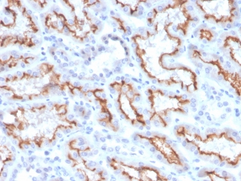 IHC staining of FFPE human kidney with recombinant Interferon gamma antibody (clone IFNG/3996R). HIER: boil tissue sections in pH 9 10mM Tris with 1mM EDTA for 10-20 min and allow to cool before testing.~
