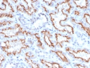 IHC staining of FFPE human kidney with recombinant Interferon gamma antibody (clone IFNG/3996R). HIER: boil tissue sections in pH 9 10mM Tris with 1mM EDTA for 10-20 min and allow to cool before testing.