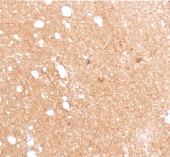 IHC staining of FFPE human brain with Beta Tubulin antibody (clone TBBT3-1). HIER: boil tissue sections in pH 9 10mM Tris with 1mM EDTA for 10-20 min and allow to cool before testing.~