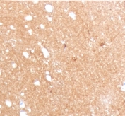 IHC staining of FFPE human brain with Beta Tubulin antibody (clone TBBT3-1). HIER: boil tissue sections in pH 9 10mM Tris with 1mM EDTA for 10-20 min and allow to cool before testing.