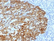 IHC staining of FFPE human tonsil with Basic Cytokeratin antibody (clone DE-SQ). HIER: boil tissue sections in pH 9 10mM Tris with 1mM EDTA for 20 min and allow to cool before testing.